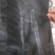 Hombre baleado durante la madrugada permanece en urgencias del Hospital de Traumatología