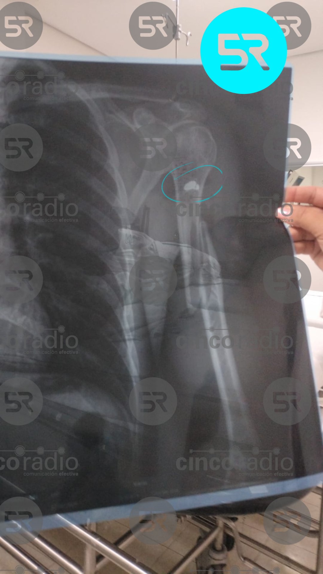 Hombre baleado durante la madrugada permanece en urgencias del Hospital de Traumatología