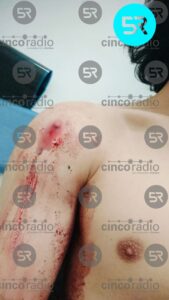 Hombre baleado durante la madrugada permanece en urgencias del Hospital de Traumatología