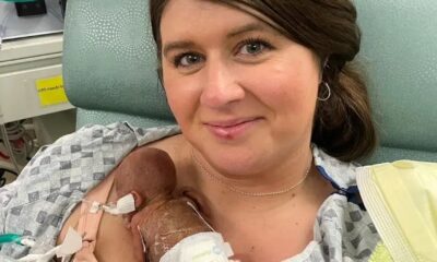 Bebé con 21 semanas en Iowa rompe récord mundial al sobrevivir Bebé con 21 semanas en Iowa rompe récord mundial al sobrevivir