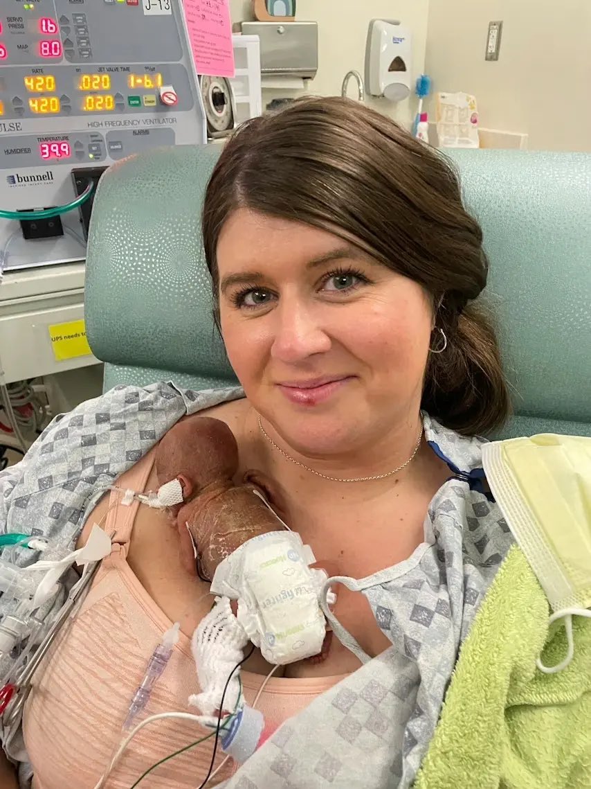Bebé con 21 semanas en Iowa rompe récord mundial al sobrevivir Bebé con 21 semanas en Iowa rompe récord mundial al sobrevivir
