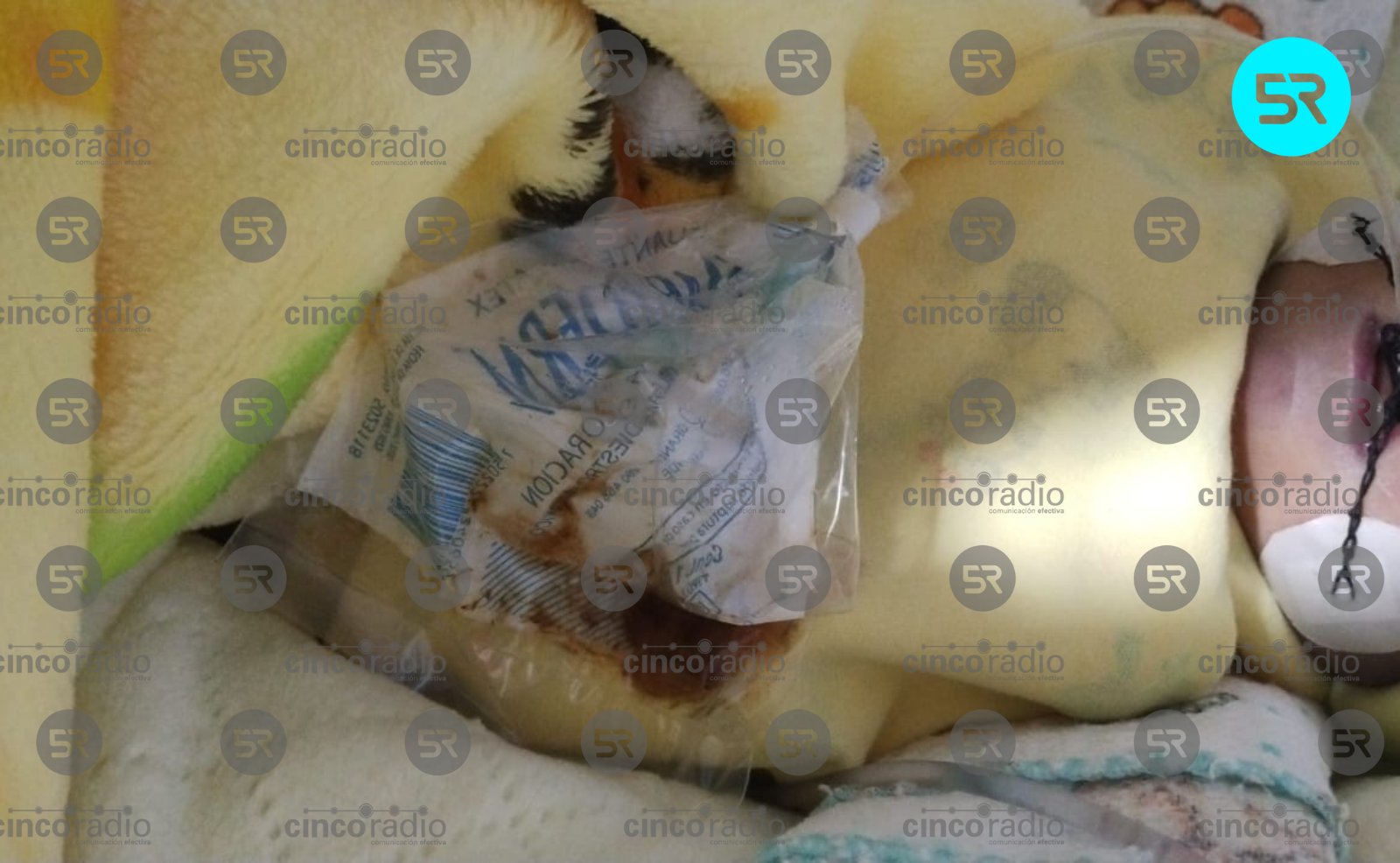 Recién nacido falleció tras dificultades respiratorias; familia denuncia negligencia, atención irregular y encubrimiento por parte del hospital.