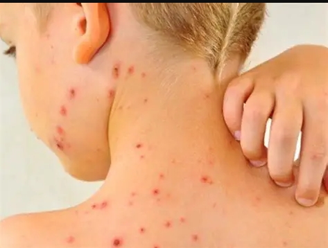 La jornada se realiza de 9:00 a 17:00 horas; también se ofrece la vacuna contra neumococo como parte de la estrategia preventiva.